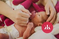Pomôžme najkrehkejším: Predčasne narodené bábätká si zaslúžia špeciálnu starostlivosť - KAMzaKRASOU.sk